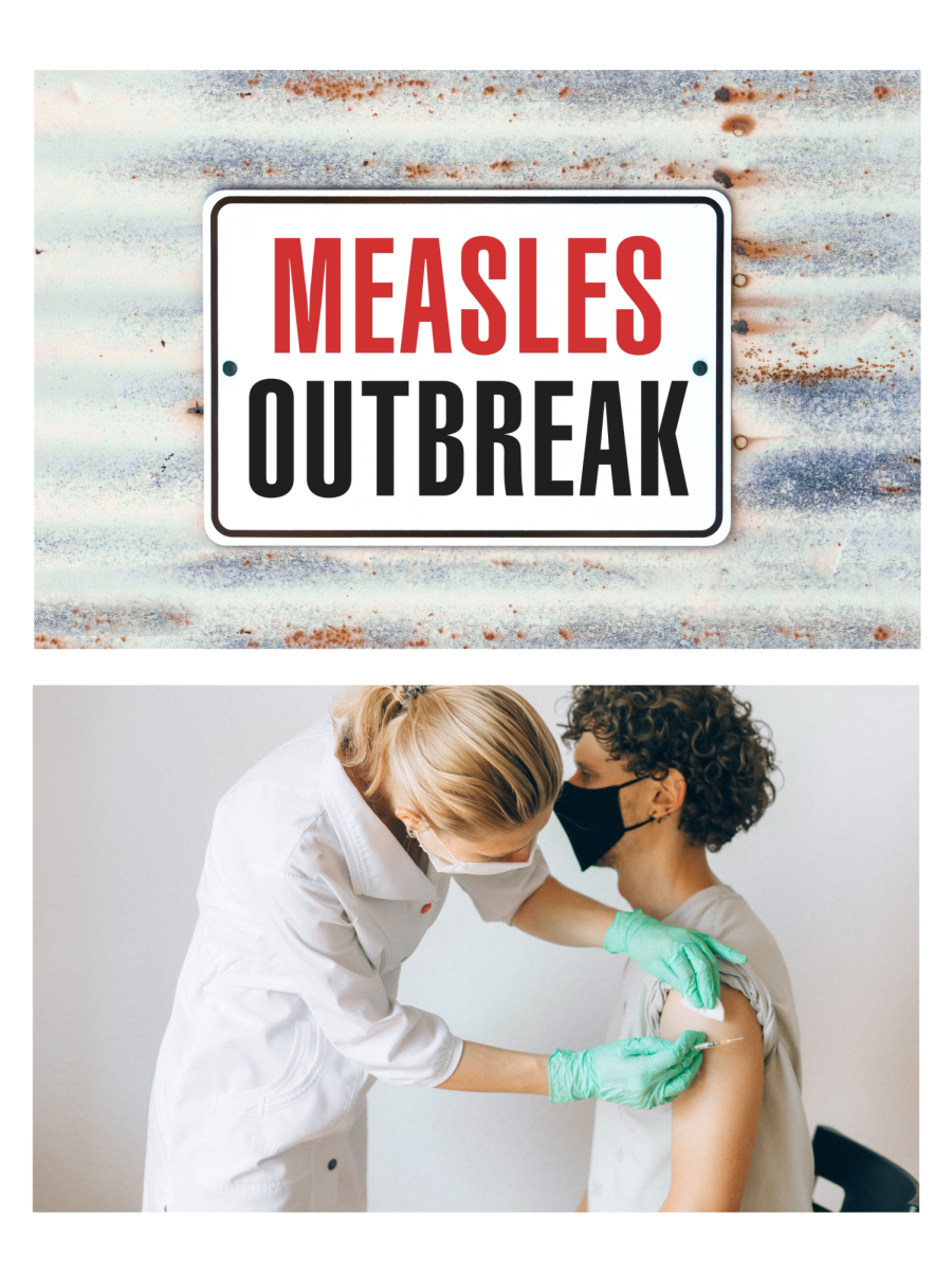 Measles in the Modern Age: What you Need to Know to Stay Healthy